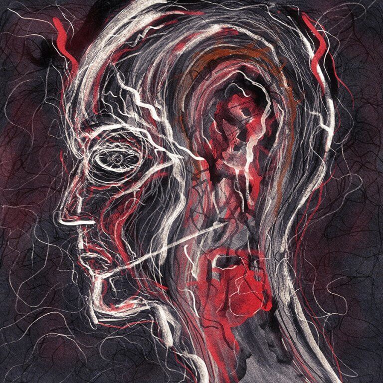 Pain After Pain